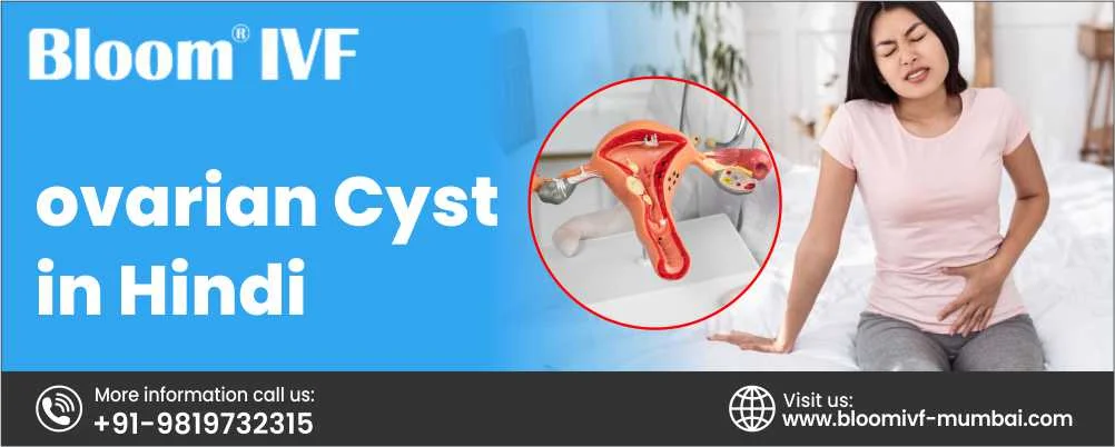 Ovarian cyst in Hindi: Meaning, लक्षण, निदान, बचाव और इलाज